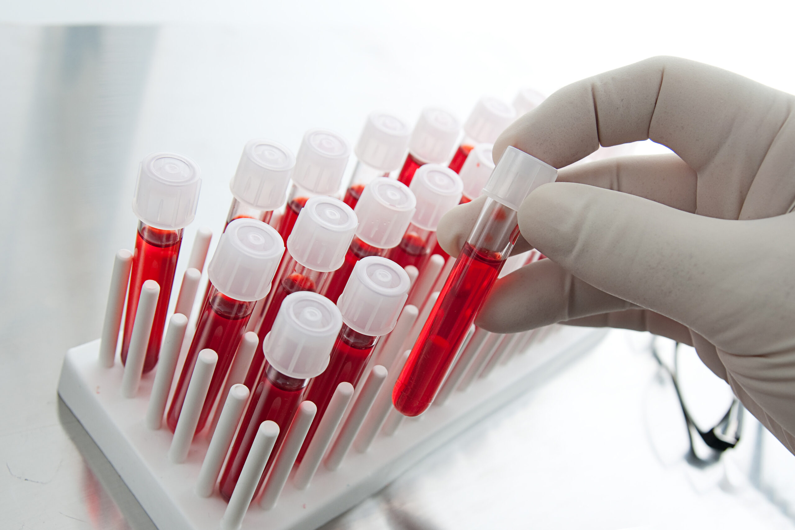 blood analysis melbourne